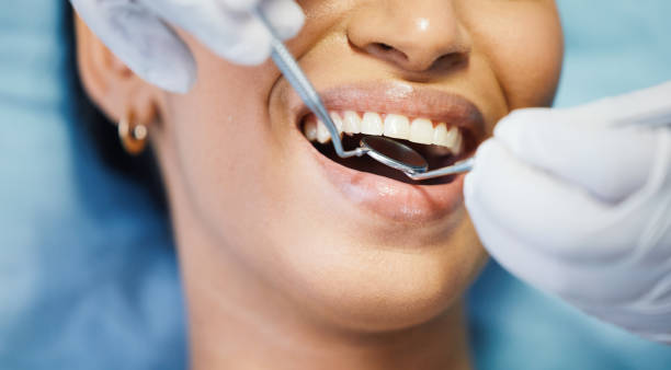 Best Emergency Tooth Extraction in Bridgeport, NE
