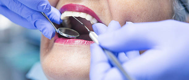 Best Emergency Root Canal Treatment in Bridgeport, NE